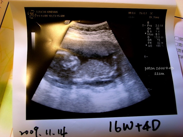 [paton。二。孕]16W+4D~boy